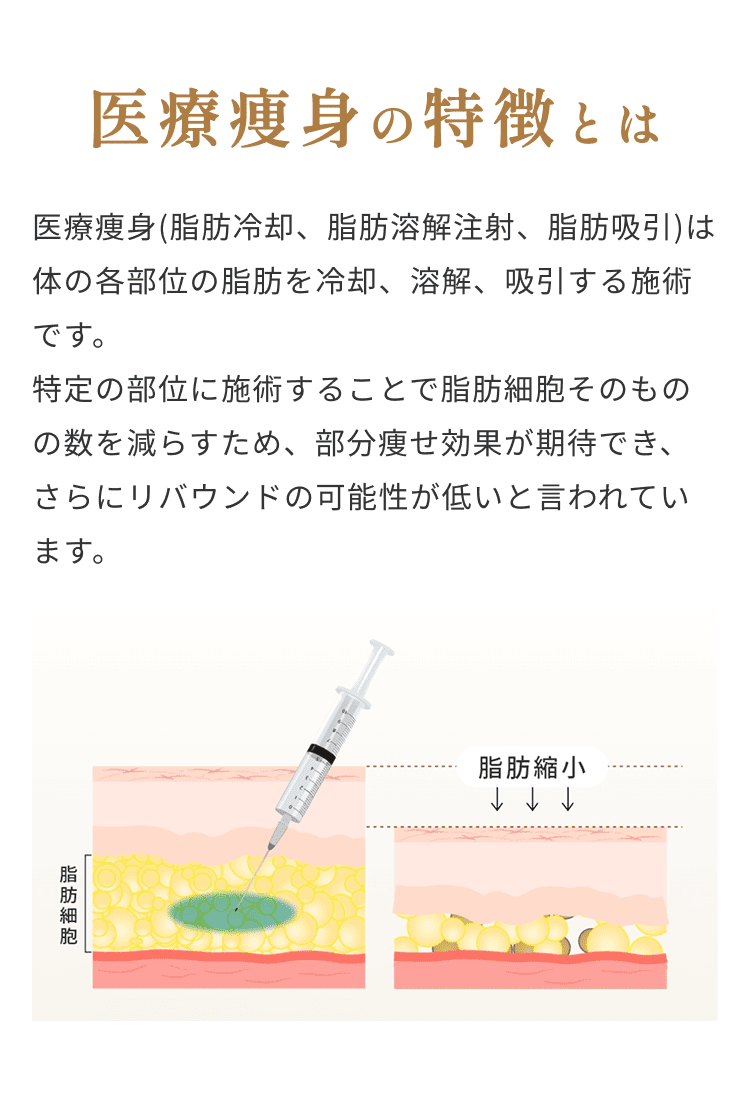 セクション画像_医療痩身の特徴とは/医療痩身(脂肪冷却、脂肪溶解注射、脂肪吸引)は体の各部位の脂肪冷却、溶解、吸引する施術です。特定の部位に施術することで脂肪細胞そのものの数を減らすため、部分痩せ効果が期待でき、さらにリバウンドの可能性が低いと言われています