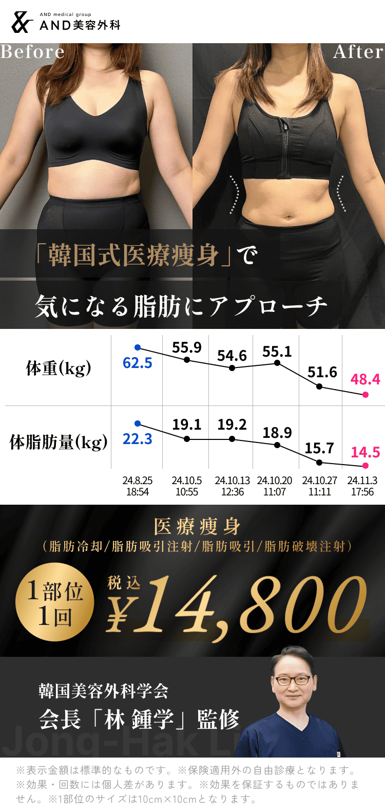 【and(アンド)美容外科公式サイト】and(アンド)美容外科の部分痩せ/代表理事林鍾学/医療痩身(脂肪冷却/脂肪吸引注射/脂肪吸引)/1部位1回税込￥14,800※表示金額は標準的なものです。※保険適用外の自由診療となります。※効果・回数には個人差があります。※効果を保証するものではありません。※1部位のサイズは10cm×10cmとなります。